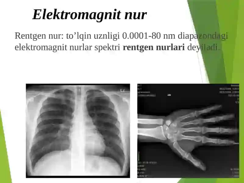 Ionlantiruvchi nurlarning biologik ta’sir mekanizmlari haqidagi gipotezalar 4