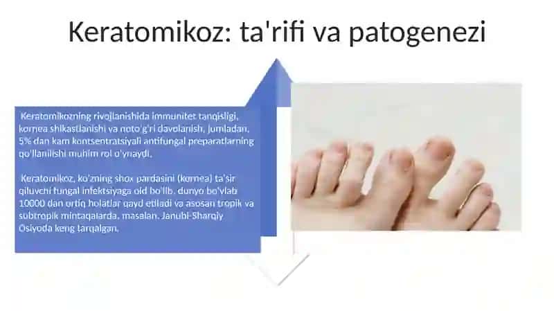 Dermatomikozlar 4