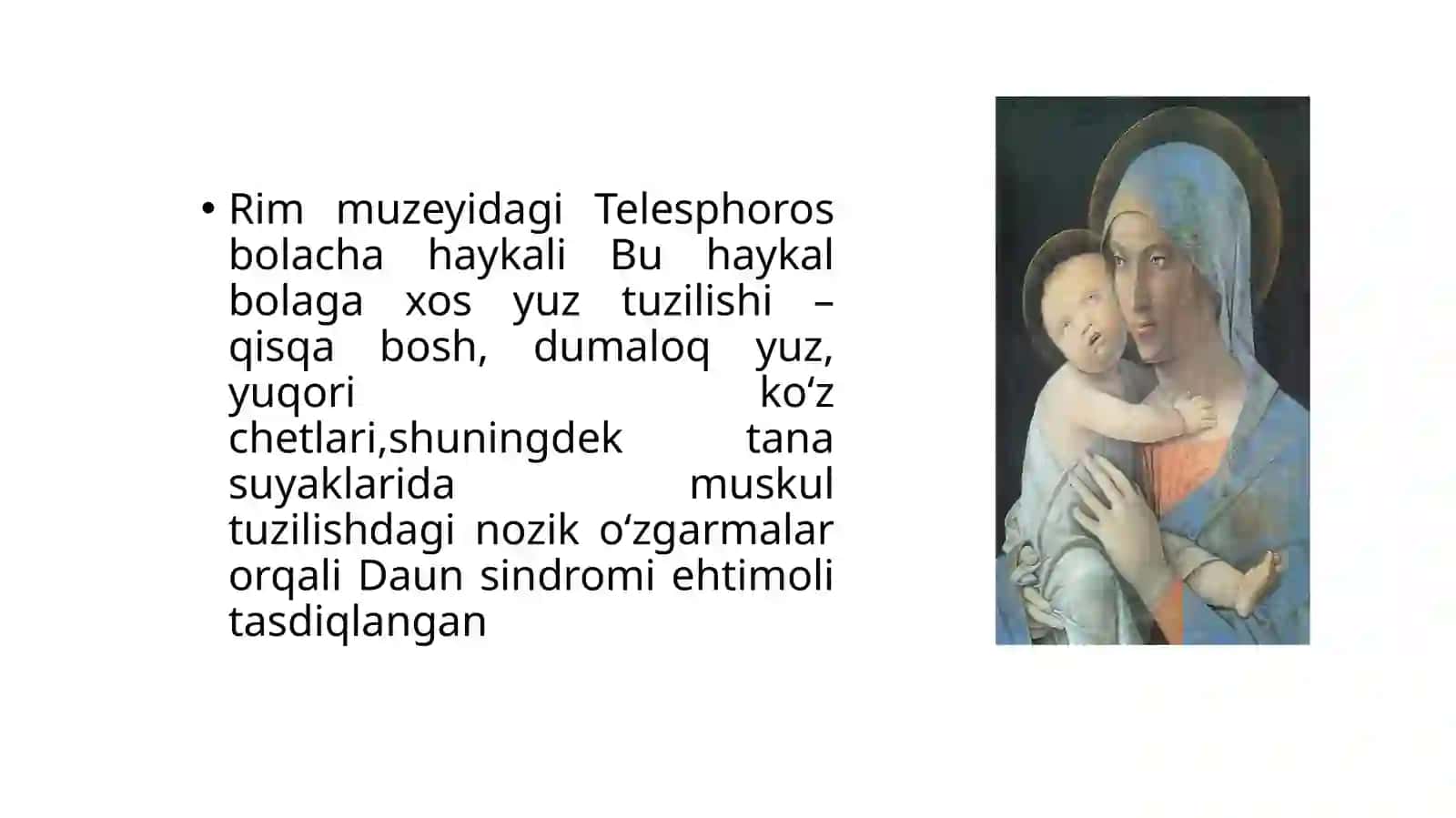 "DAUN" SINDROMI TARIXI, XROMOSOMA KASALLIKLARI HAQIDA TUSHUNCHA 4