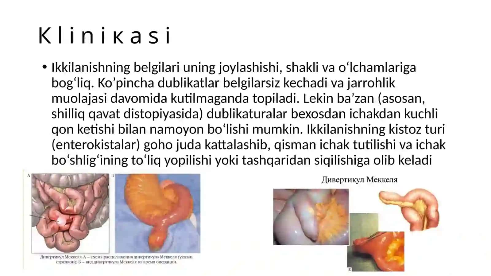 Xazmqilish nayining ikkilanishi 4