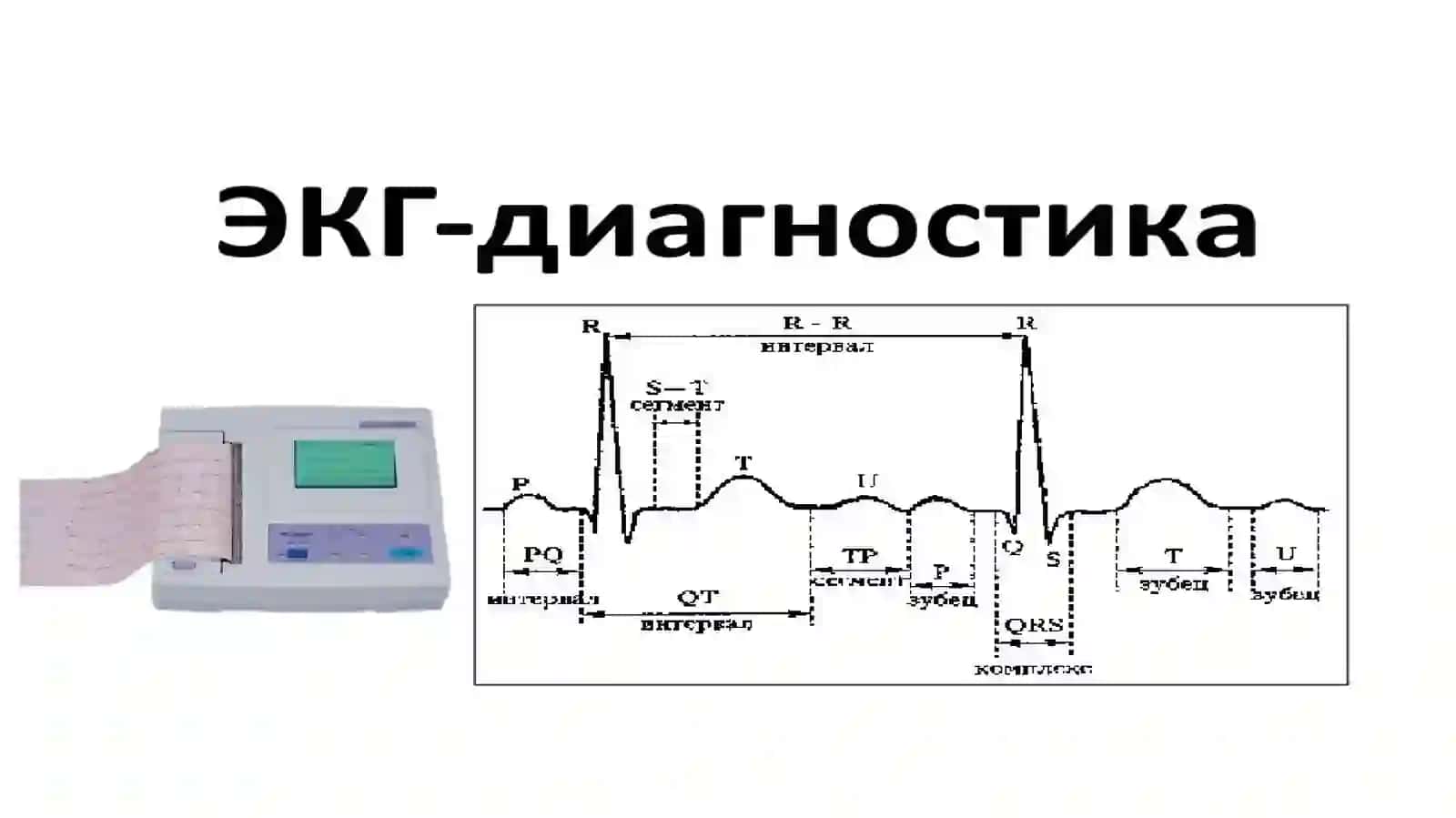 Elektrokardiografiya tekshirish usuli 4
