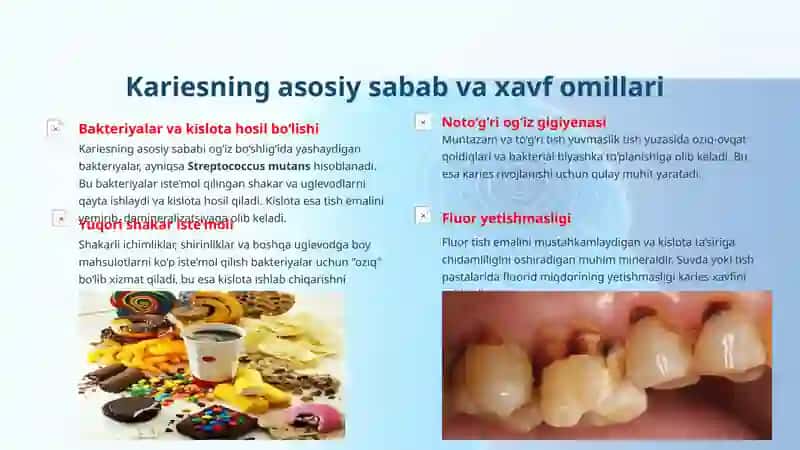 Kariesning umumiy va mahalliy profilaktikasi 4