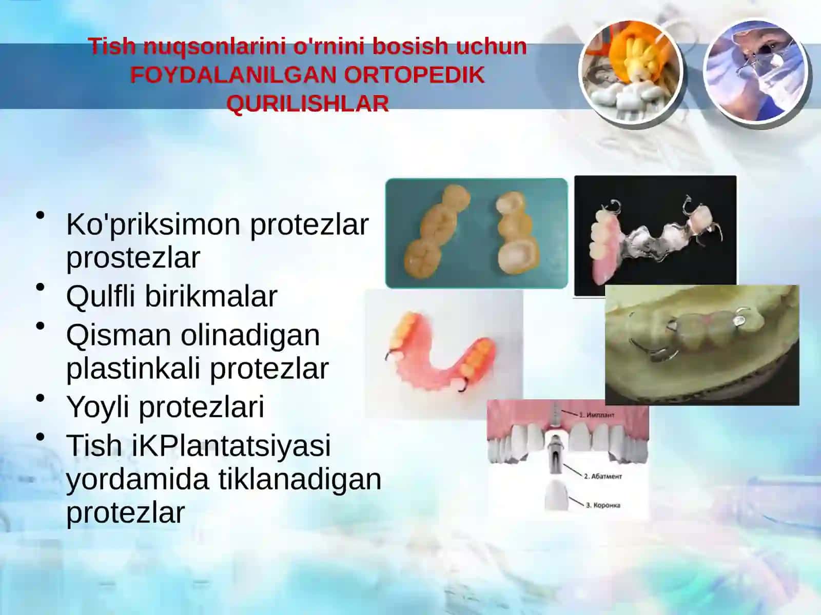 Ko'priksimon protezlar 4