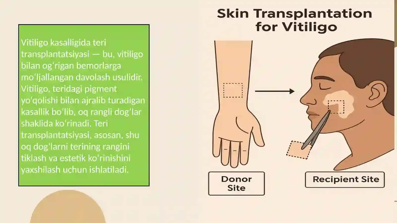 Vitiligo kasalligi va uning zamonaviy davolash usullari 4