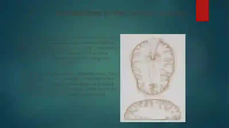Nervous System 4