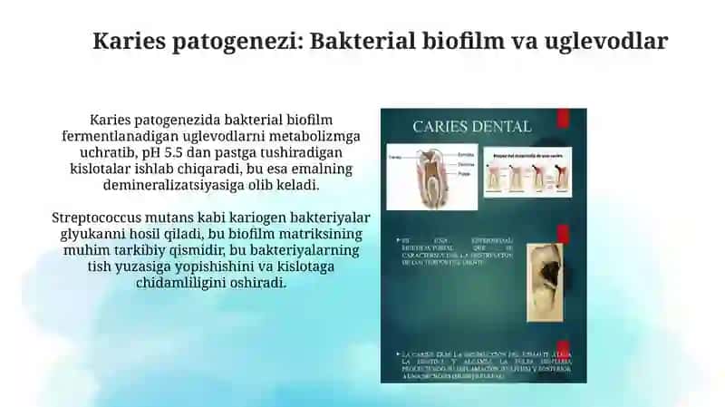 Karies, Pulpit va Nekroz Sabablari 4