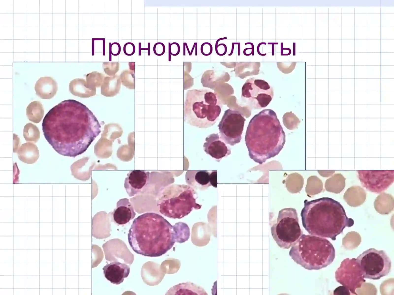 ERITROPOEZ XUJAYRALARINING MORFOLOGIYASI 4