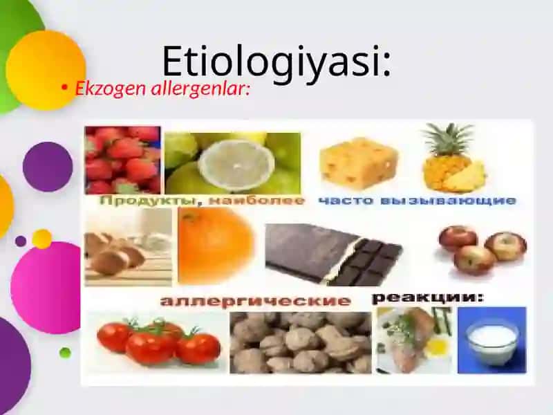 ASPIRINLI BRONXIAL ASTMA 4