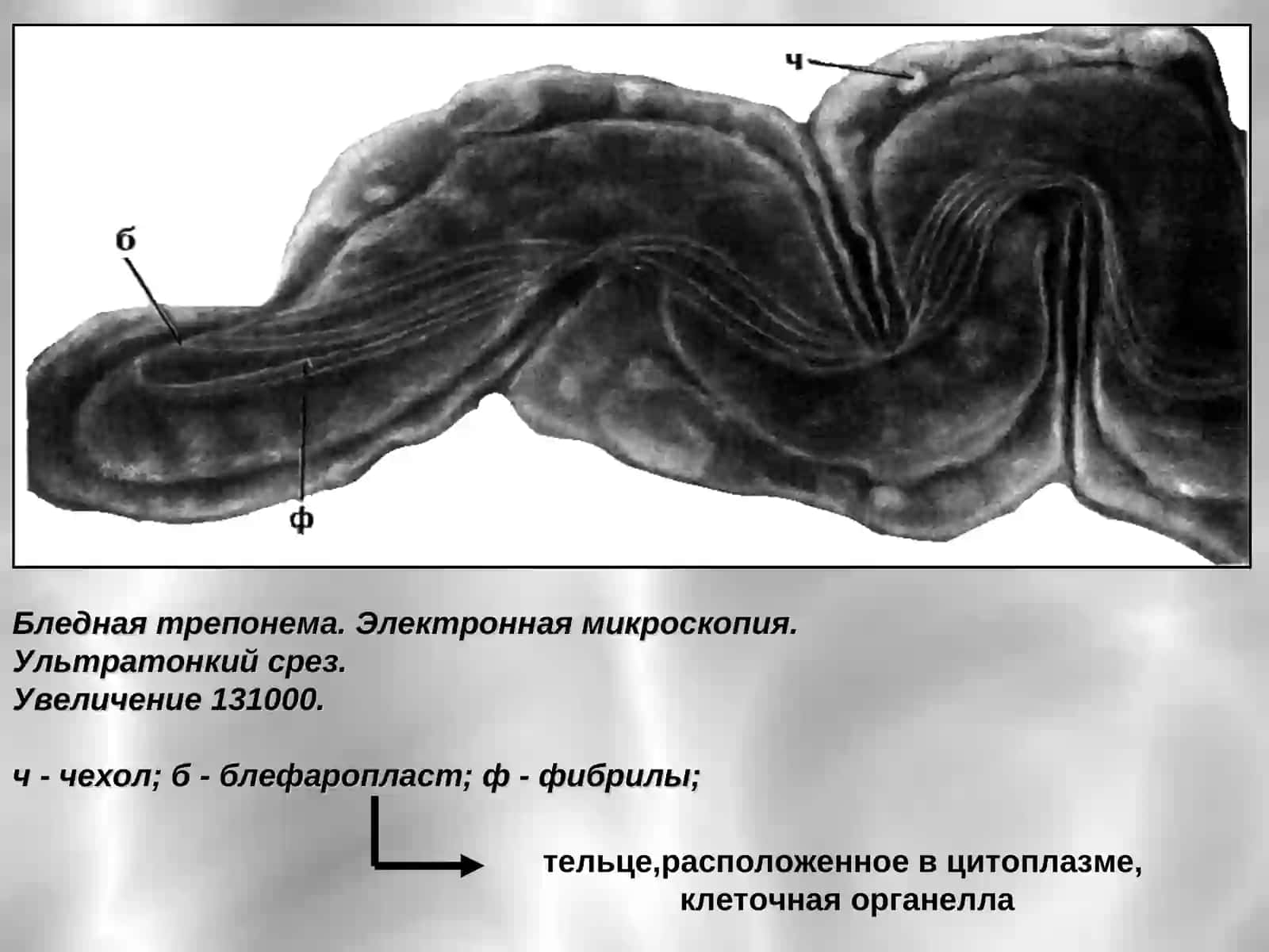 Сифилис– инфекционное венерическое заболевание 4