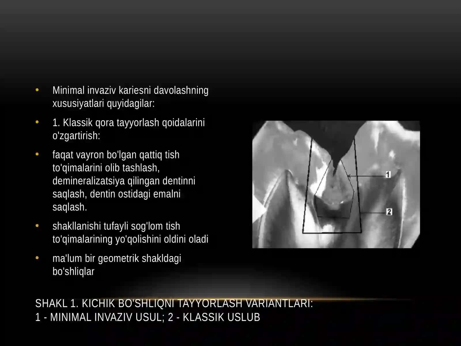 Tish qattiq toqimalarini minimal invaziv usulda charhlash 4