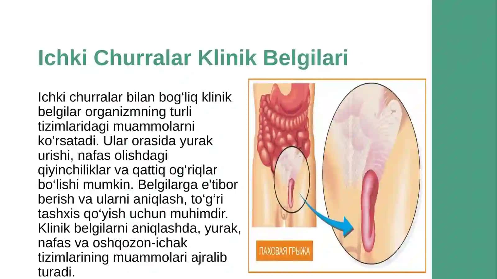 ichki churralar 4