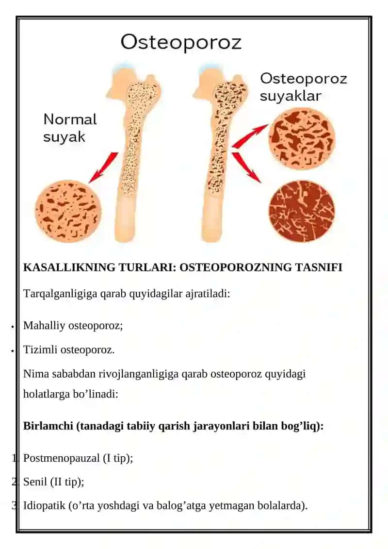 Osteoporozlar ratsional terapiyasining tamoyillari 4