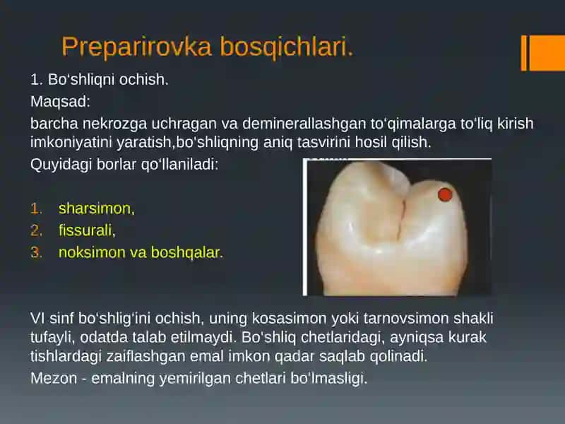 VI sinfli karies kovaklarini restavratsiya qilishning klinik tamoyillari 4