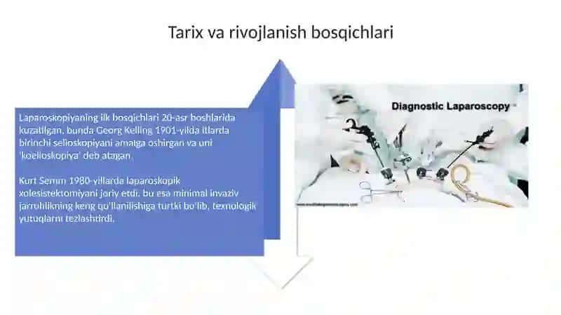 Laparoskopiyaning jarrohlikda qoʻllanilishi 4