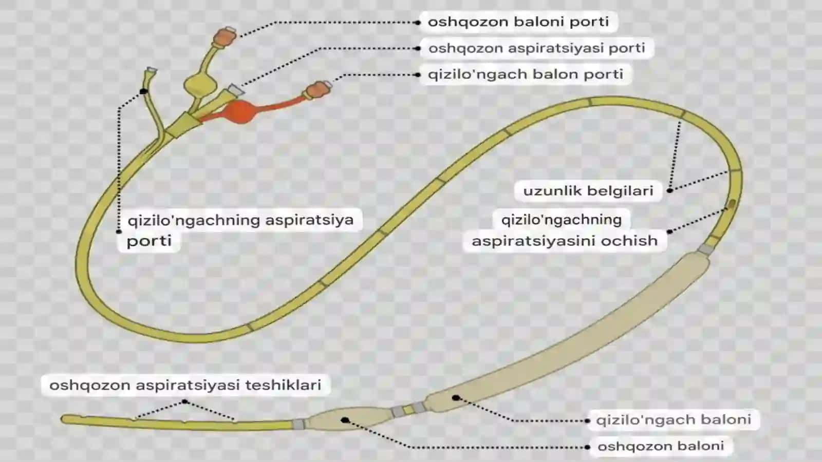 Qon ketishini vaqtincha va batammom to’xtatish usullari 4