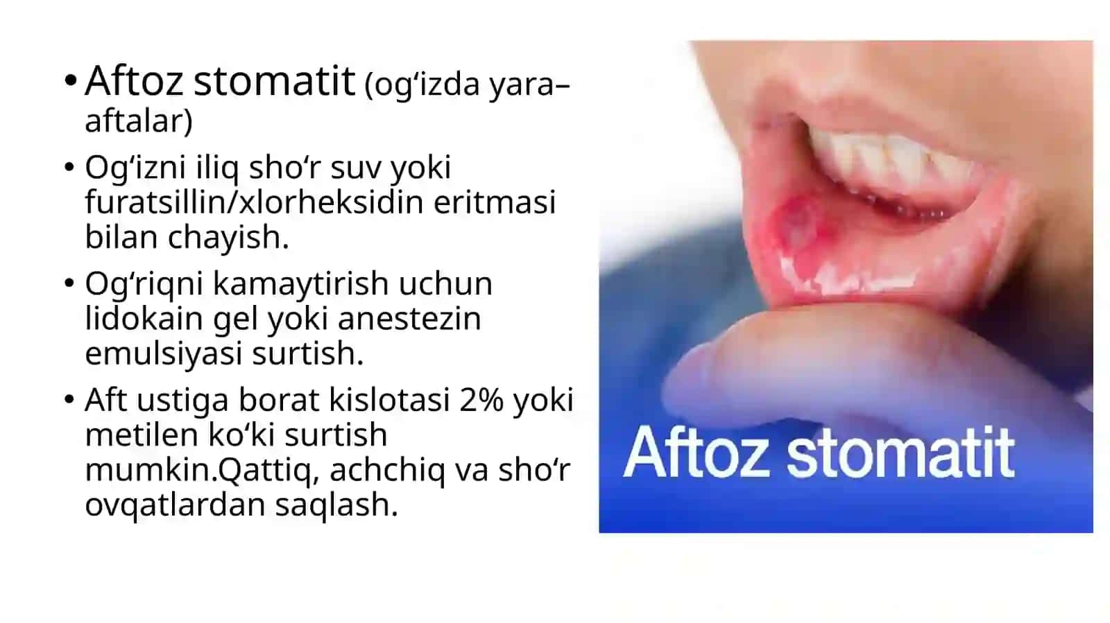 Og‘izbo‘shlig‘ishilliq pardasi kasalliklarining og‘ir shakllarida bemorga birinchi yordam muolajalari 4