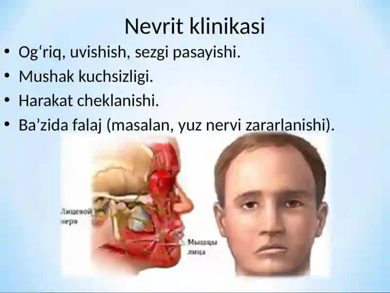 Periferik nerv sistemasi kasalliklari etiologiyasi klinikasi davolash va parvarish qilish usullari profilaktikasi. rejada nevritlar, polinevritlar haqda 4