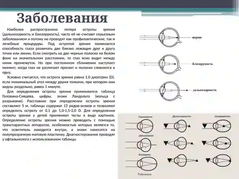 Приборы для диагностики заболеваний органов зрения 4