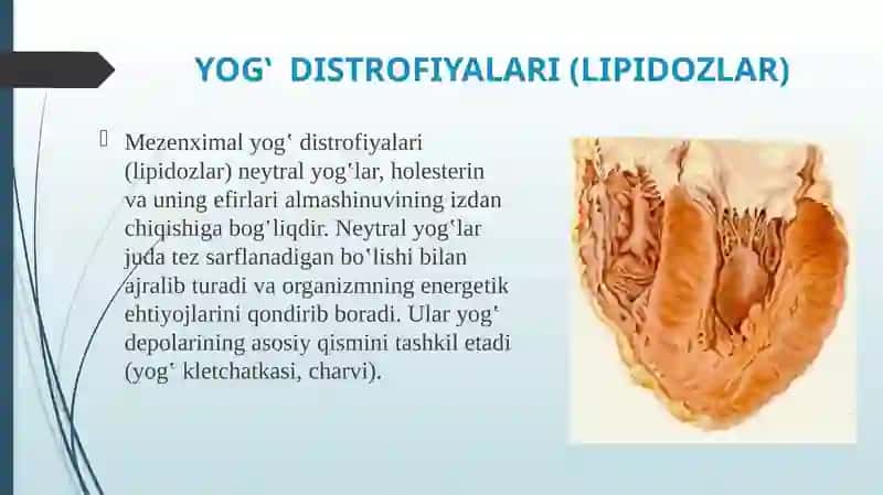 Yog' va uglevodli distrofiyalar 4