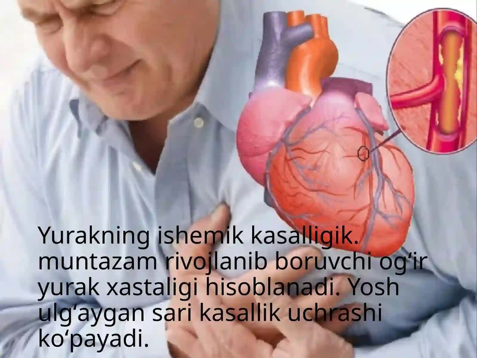 Yurakning ishemik kasalligi (Yurak ishemik kasalliklari) 4