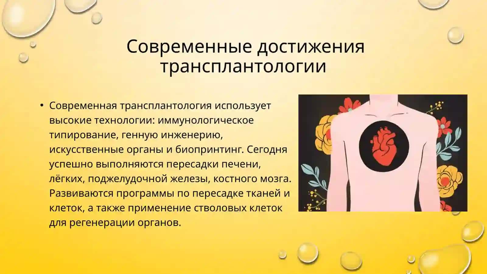Развитие трансплантации на современном этапе 4
