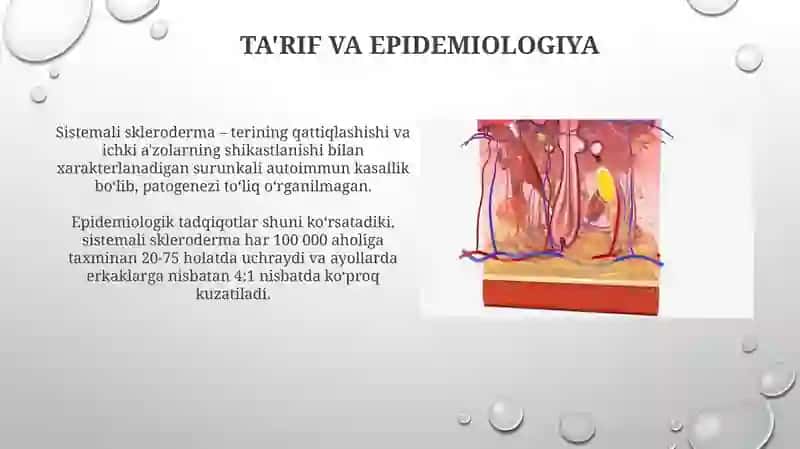 Sistemali sklerodermiya 4