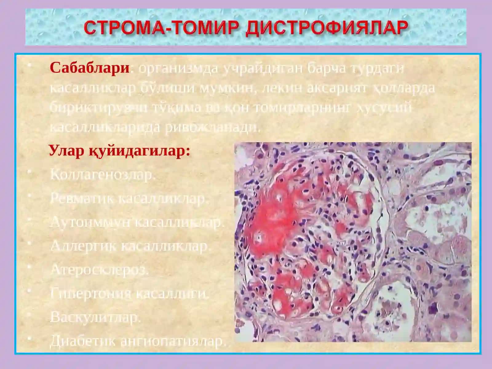 СТРОМАБУ - ТОМИРЛИ ДИСТРОФИЯЛАР 4