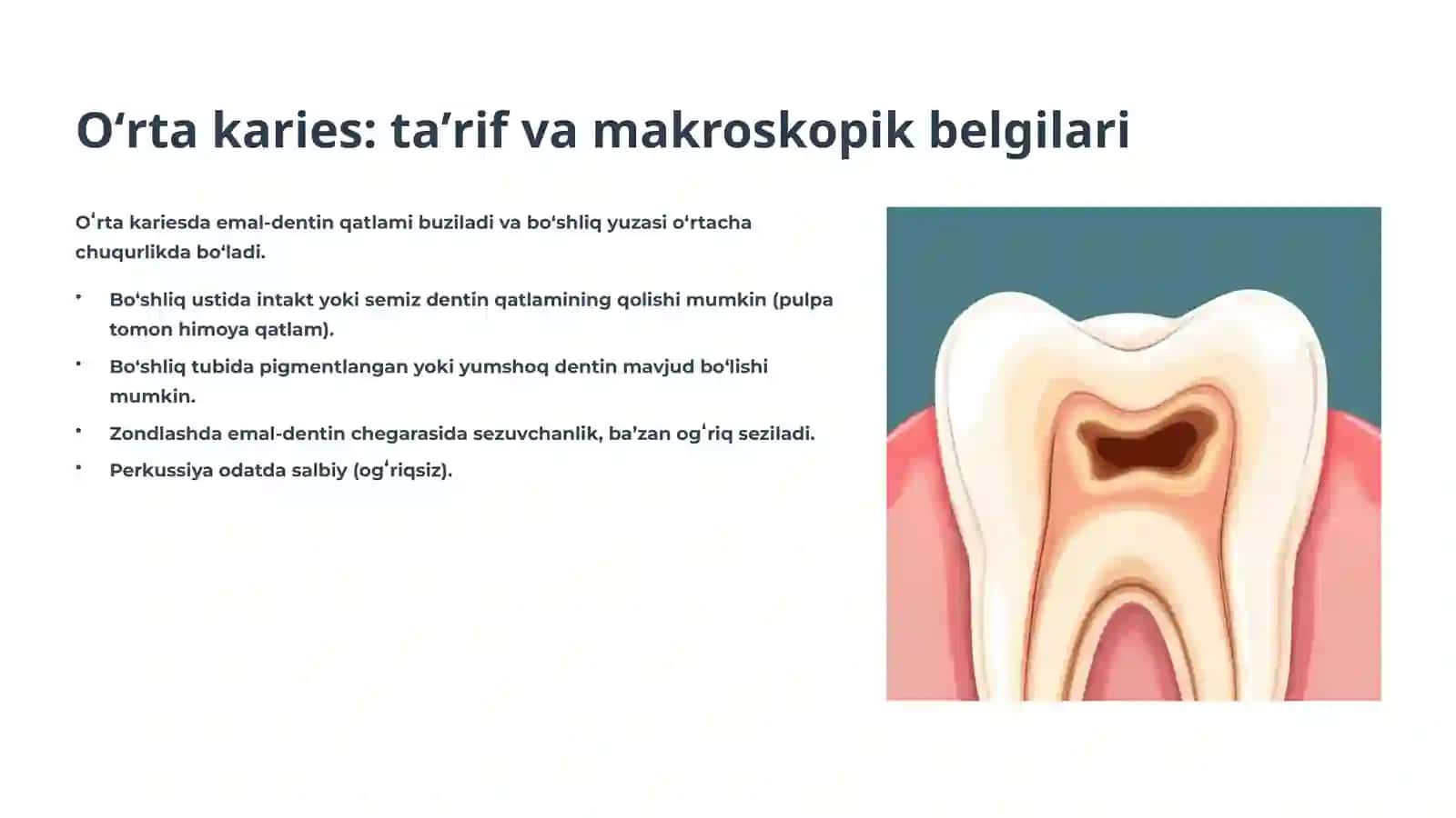 Karies: Oʻrta (Caries media) va Chuqur (Caries profunda) 4