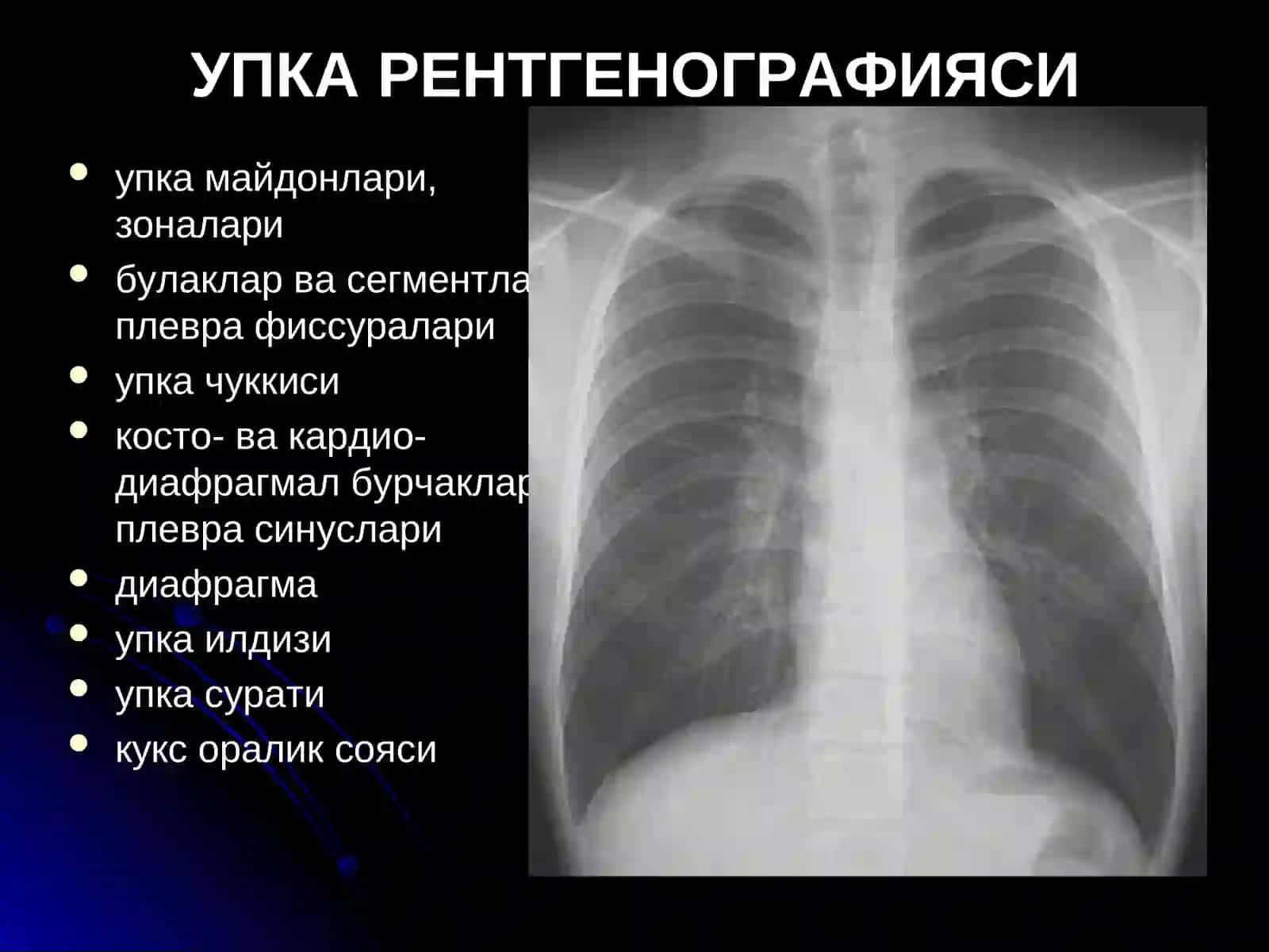 УПКА КАСАЛЛИКЛАРИНИНГ НУР ТАШХИСИ 4