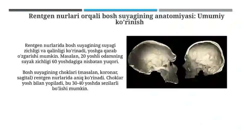 Kalla suyaklarining rentgenatomiyasi. Kalla suyagining yoshi va jinsiy tafovutlari 4
