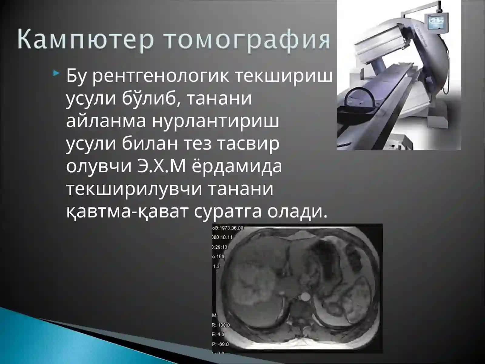 Терапияда хамширалик иши 4