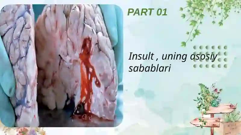 Insult,uningasosiysabablari 4