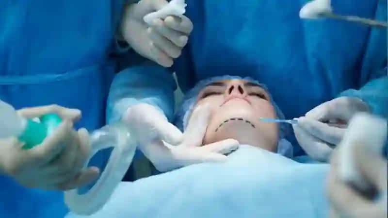 Yuzdagi plastik operatsiyalar xususiyatlari 4