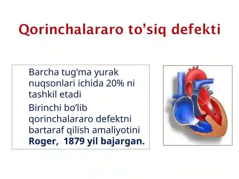 tug'ma yurak nuqsonlari 4