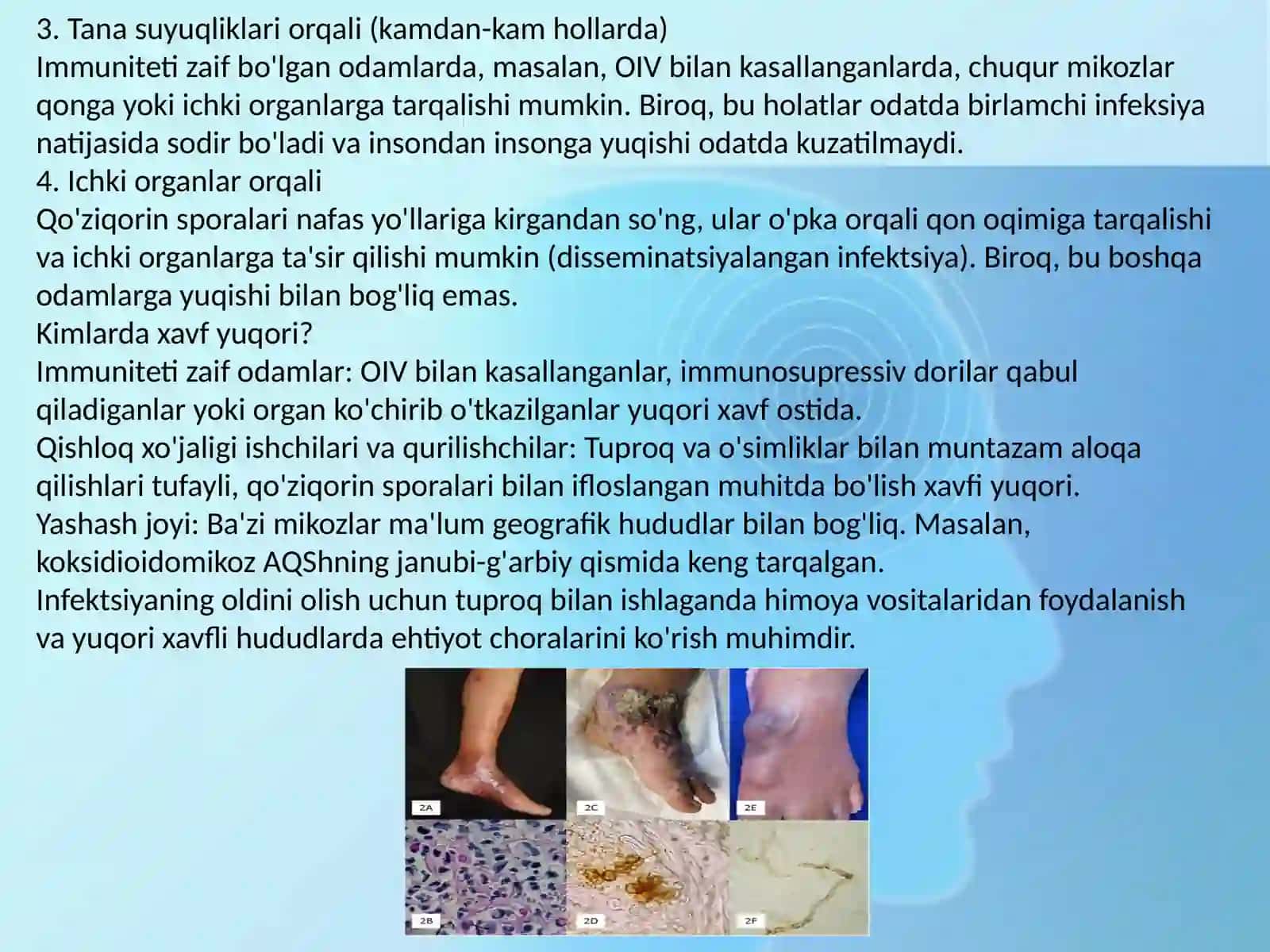 ChUQUR MIKOZLAR 4