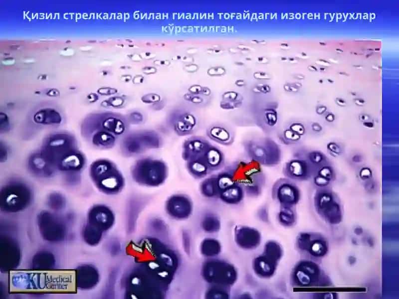 Тоғай ва суяк тоқимаси 4