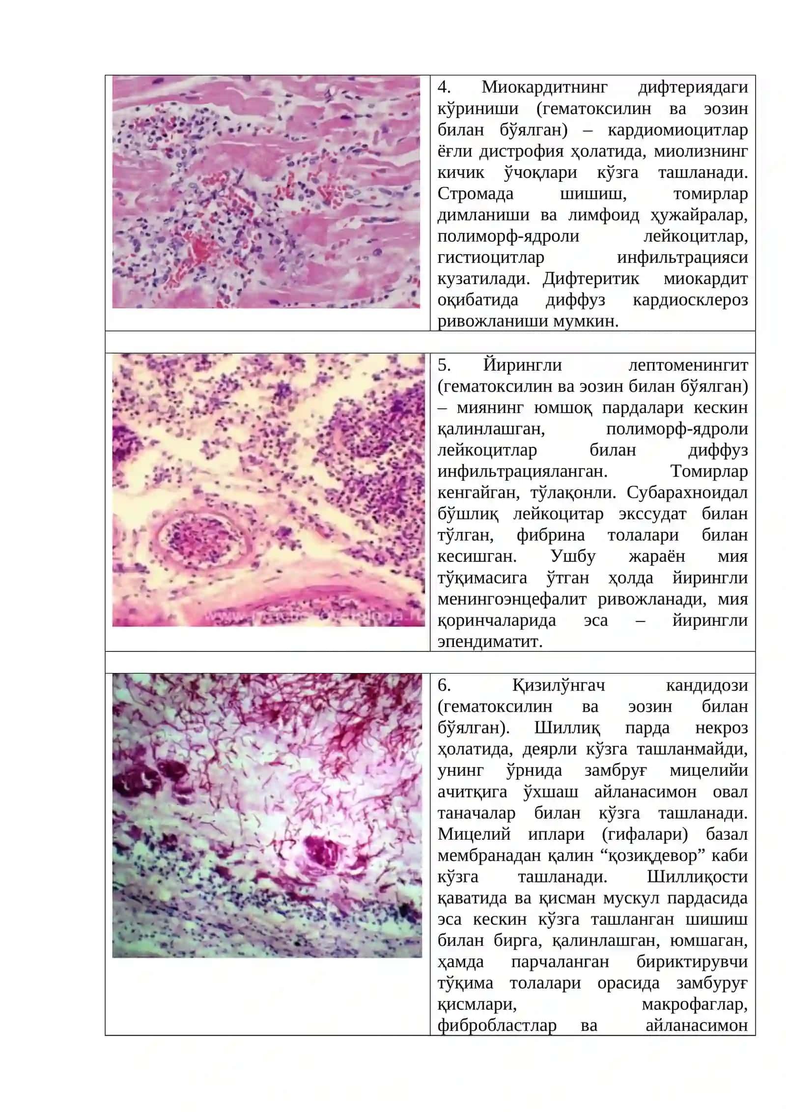 Йирингли инфекциялар ва сепсис 4