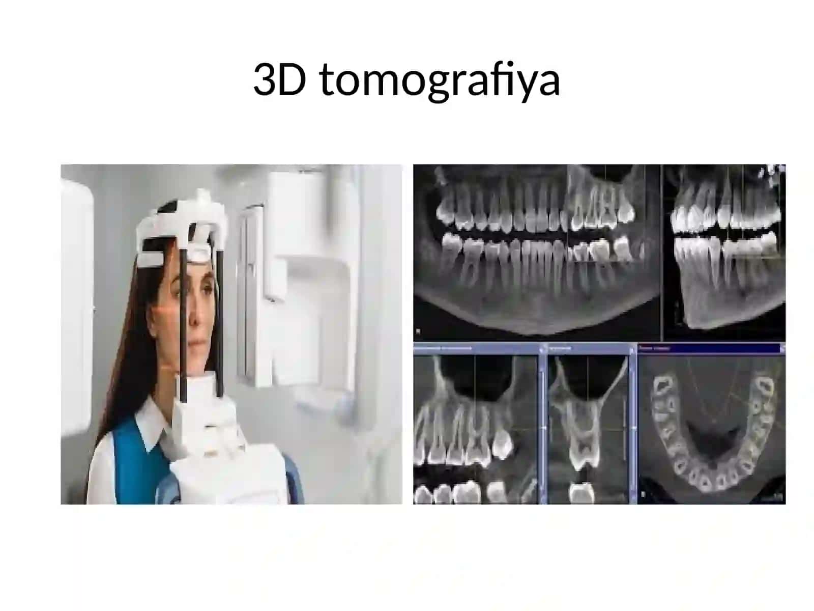 Tish qurilmalarining turlari. Zamonaviy stomatologik qurilmalar 4