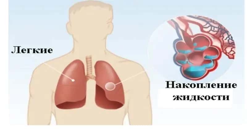 Bronxolitik vositalar 4