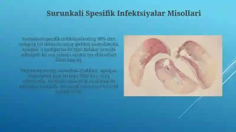 Umumiy Yiringli Infektsiyalar 4