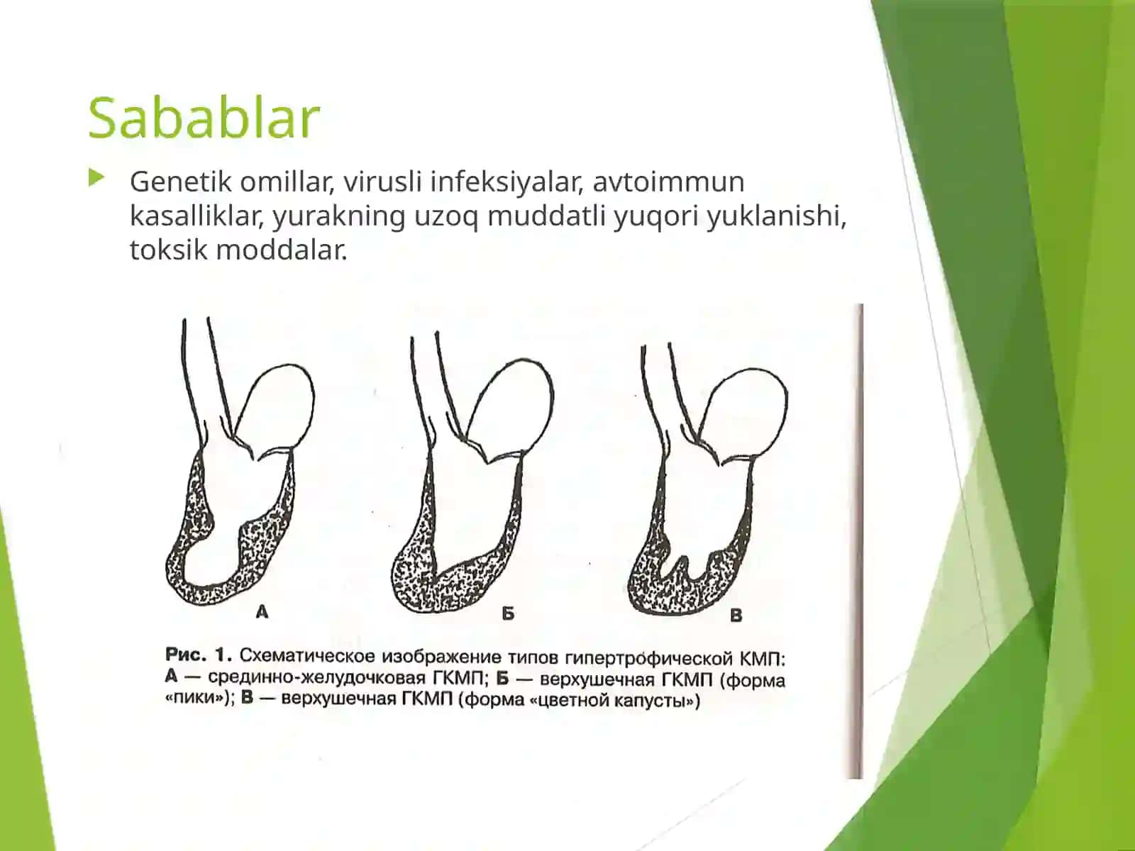 Kardiomiopatiya turlari 4