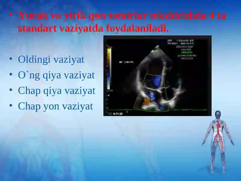 Yurak va yirik qon tomirlar kasalliklarining kompleks nur diagnostikasi 4