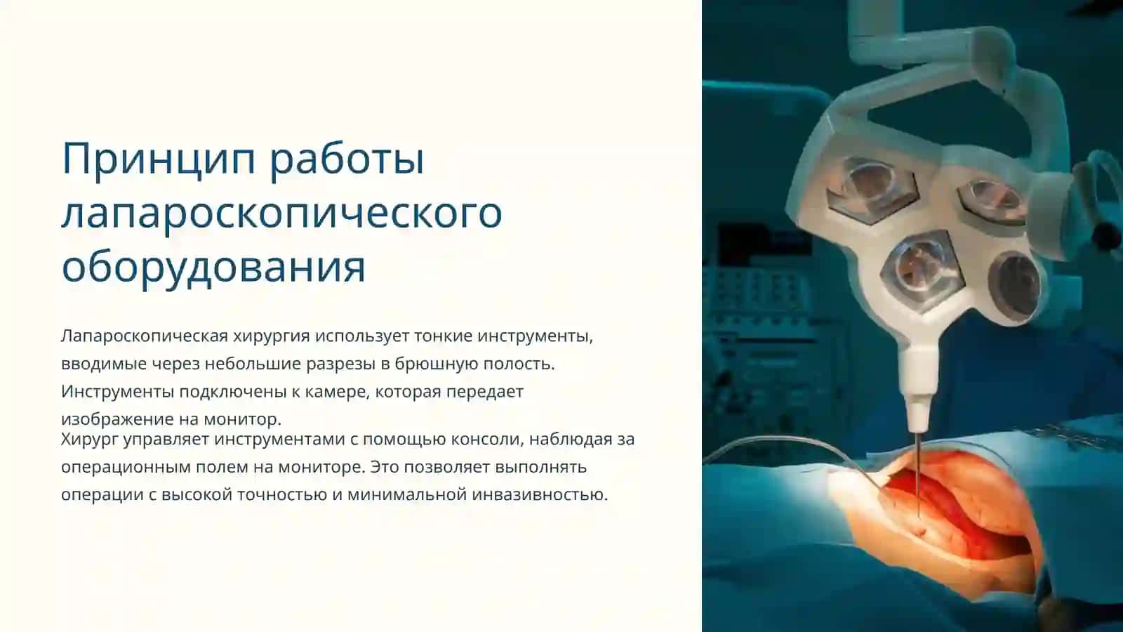 Лапароскопическая хирургия: инновационный подход в современной медицине 4