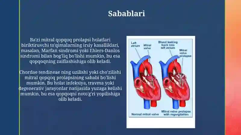 Mitral qopqoq prolapsi 4