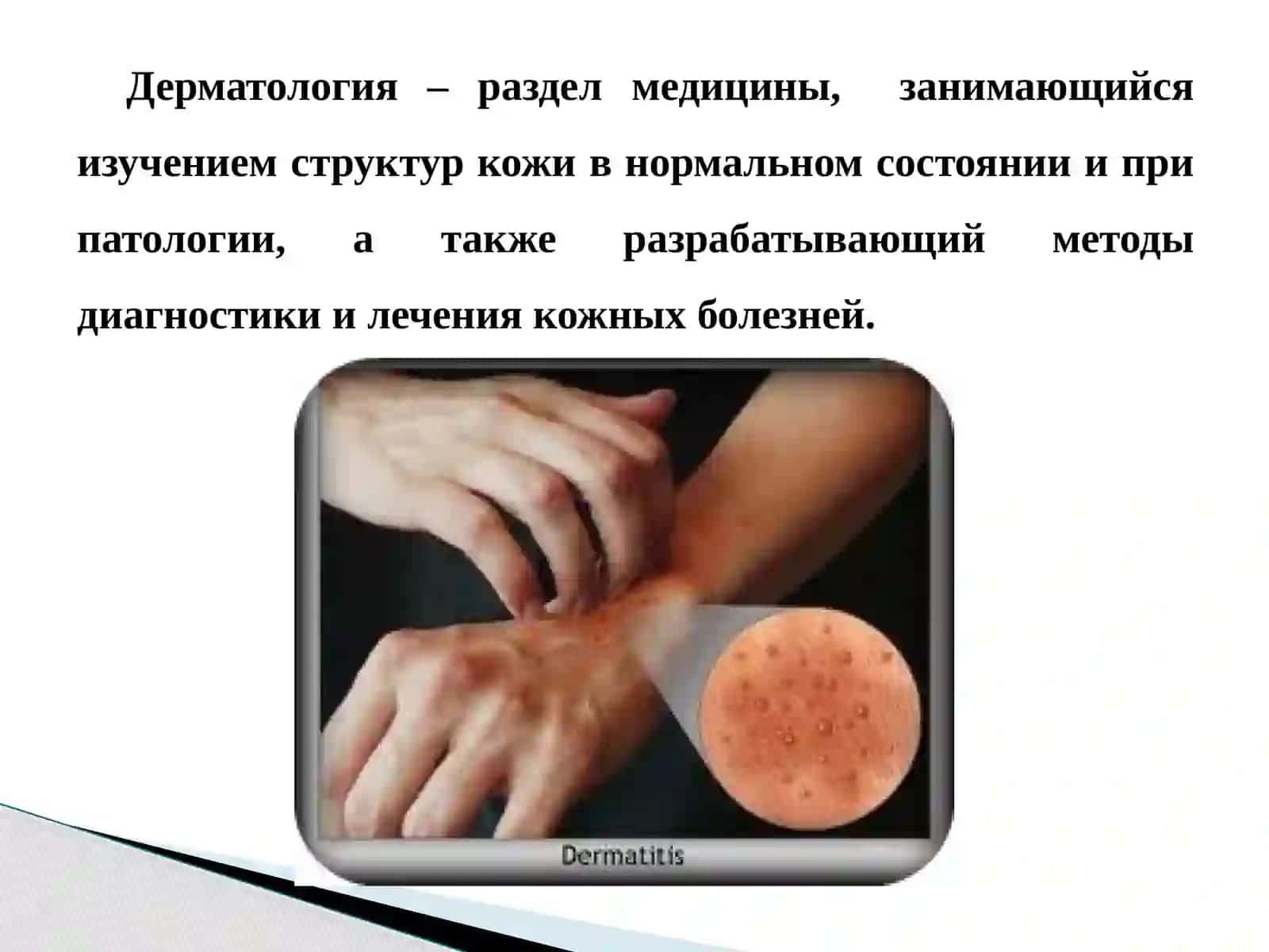 Заболевания кожи 4