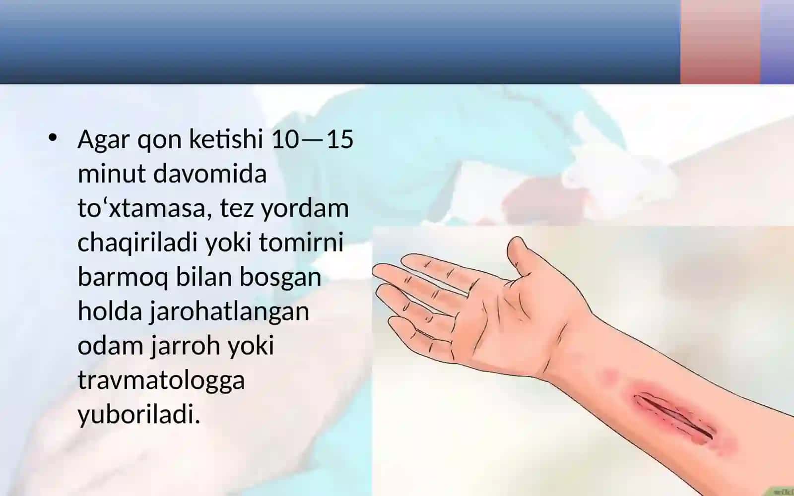 Teri shikastlanganda birinchi yordam 4