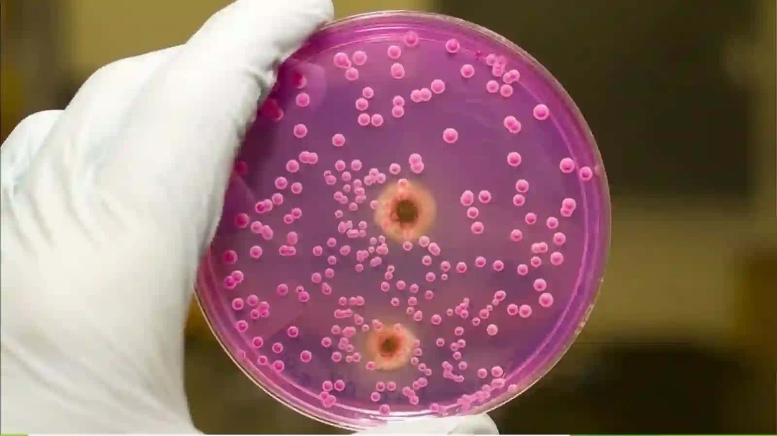 Endogen parazitar kasalliklar, klassifikatsiyasi, patogenezi, laboratoriya tashxisi 4