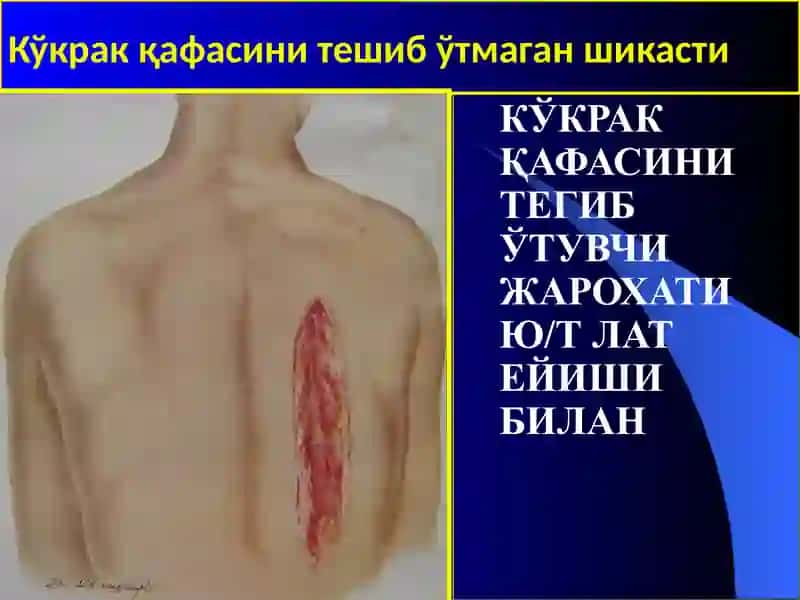Тошкент Тиббиётакадемияси Травматология, Ортопедия Ҳарбий дала жаррохлиги ва Нейрожаррохлик Кафедраси 4