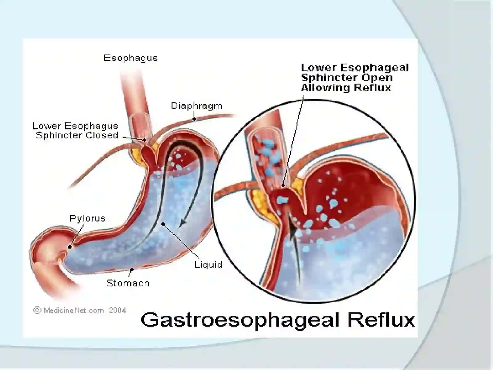 Gastrointestinal diseases 4