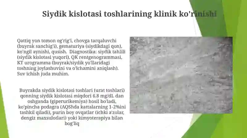 Siydik kislotasi toshlarining jarrohlik davolash usullari 4
